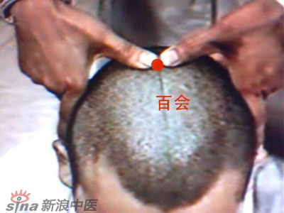 艾灸常用的保健穴有哪些？--百會